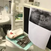 Monitoring stážujúcich študentov